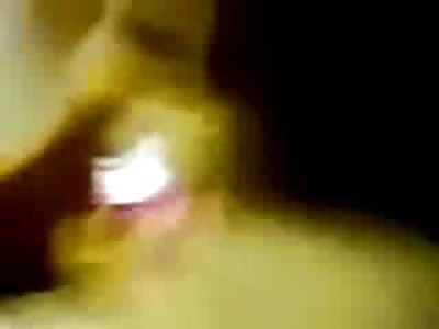 OUCH: Mans Unfortunate Run in with a Boat Propeller 