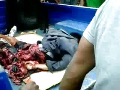 Boy slightly Ripped in Half held Together by Muscle Tissue and Ligaments 