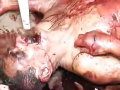 Elderly Man Brutally Stabbed Mutliple Times and Lies in a Pool of Blood