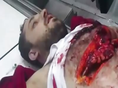 Ehhhh, It's Just a Flesh Wound Hakbib....Get your Ass Up!!