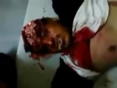 Foaming at the Mouth Brains and Scalp Ripped Off...Yea, it's a Pretty Bad Day