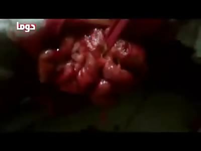 Gruesome Aftermath has his Intestines Leaking out his Side