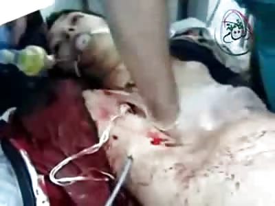 INTENSE: CPR So Hard you Can Hear the Ribs Breaking...DAMN!