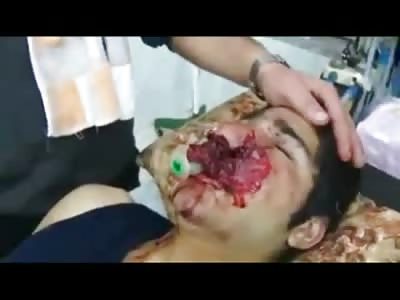 Man with Gruesome Face Stares in Shock at the Ceiling