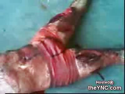 Machete and Knife Attack in Prison