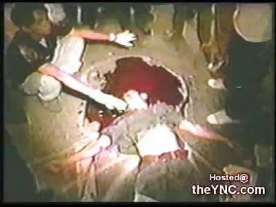 Horrific Aftermath shows a Man's Brain crushed out of his Head