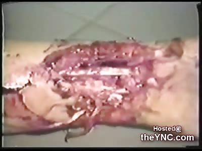 Horrific Aftermath of a Girl Slaughtered by her Husband