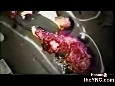 Man left with his Guts all over the Road and his Hand through his Stomach