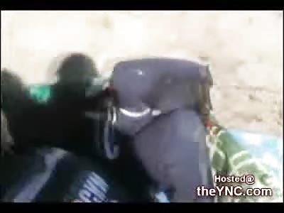 Truck Driver loses his Foot and Calls his Wife