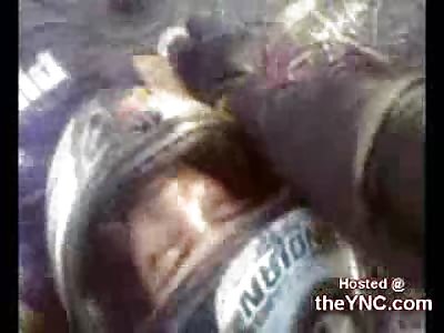 Italian Biker has both Arms ripped completely off in a Horrible Accident