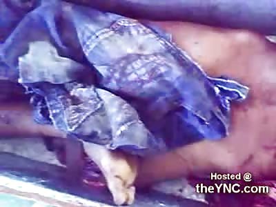 This is why you Shouldn't Pass Out on Train Tracks