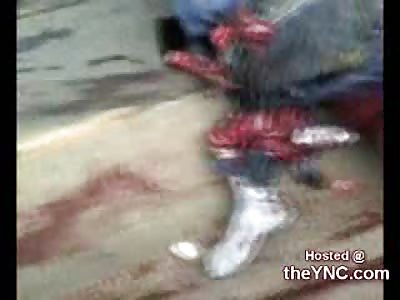 This is why You Should Avoid Getting Hit by a Dumptruck (Very Graphic)