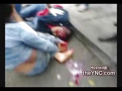 Cute Girl with a Severed Foot talks on her Cell Phone and Screams in Pain