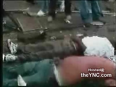 Possibly The Most Gruesome Accident Scene Ever 