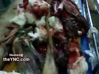 Shocking Video shows a Man Run Over by Metro, Legs Ripped Off, Still Alive (Very Graphic 18 + Only)