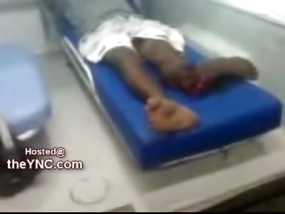 Dont Try to Move that Leg Kid......