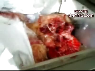 VERY GRAPHIC: 3 Kids and One Man Run Over by a Bus (18+ For this Video)