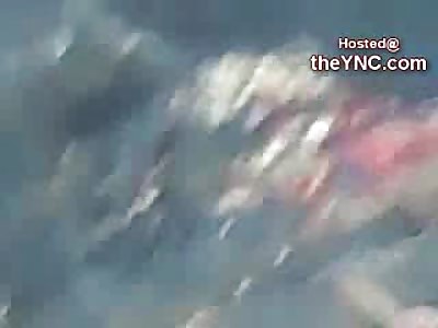 Burned to Death in Accident is Removed from his Car