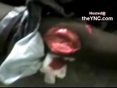 Young Boy Beaten to Death with a Machete