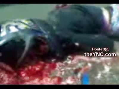 Graphic Video: Young Female Head Crushed through Her Helmet Dead on the Street (Comments Disabled)