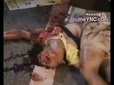 Female Thrown 40 Feet and Landed on her Head has Every Bone Broken in her Body