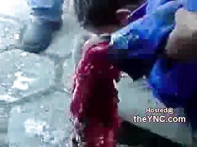 Worker has His Hand Ripped off by Machine...All Thats Left is a Shredded Mess