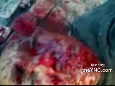 One Eyed Blank Stare: Man Murdered with Stones in Brazil 