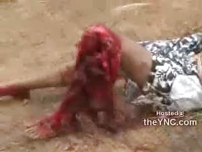 Flapping in the Wind....Flesh Rpped from the Bone after Brutal and Painful Road Accident