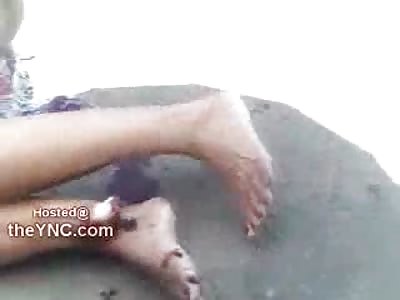 Put the Phone Down...Woman with Horrible Compound Fracture Chit Chats in Pain