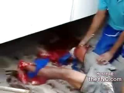 Man Attempts Suicide but Loses both Feet Instead (Info from Source)