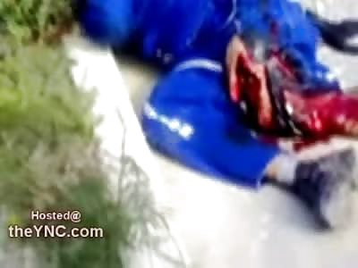 Biker with Shredded Leg doesnt Know what to Do