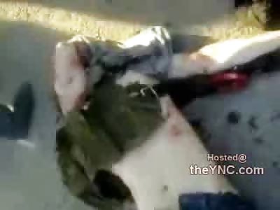 Dead Soldiers Ripped apart Dead on the Field after Battle