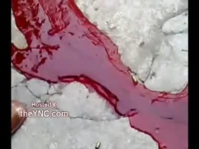 Young Teen Shot in the Head and Face Bleeding a River onto the Sidewalk 