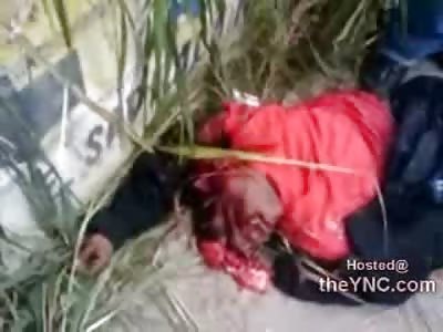 100% Gore: Man has Brain Fall Out of his Head as Technicians move Him (Watch Full Video for close Ups)