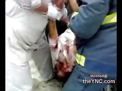 Very Dead Male Female? Blank Stare into the Sky