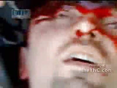 Chaos in Syria Leads to Crazy Bloodshed 