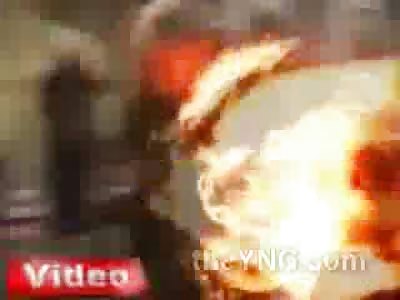 Older Gentleman thinks Setting himslef on Fire will Change Things in Turkey 