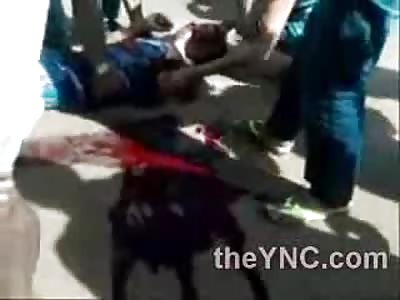 Girl in Shock and her Boyfriend has His Arm Ripped Clean off his Shoulder