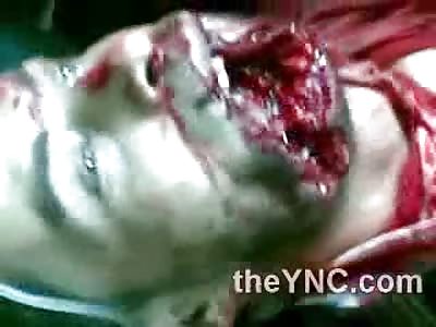 Man in Shock has nothing left but his Buck Teeth on his Face