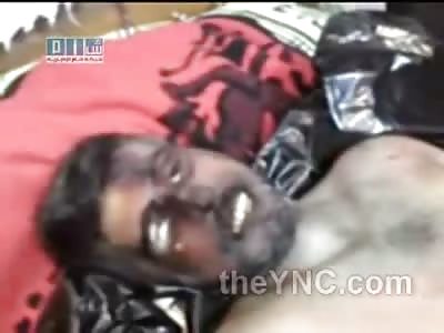 Weird Looking Dead Dude Displayed 