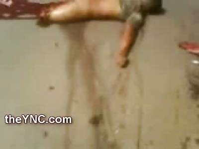 Legs Ripped Off of Dead Man in the Road and Strewn about  the Street