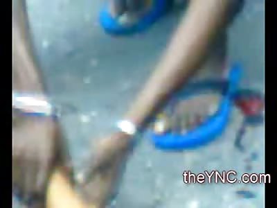 Dazed and Confusd Girl with a Dent on her Head and a Broken Arm gets all the Attention at the Accident Scene