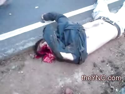 Different Cell Phone Higher Quality of Biker with Ripped Off Face after Accident