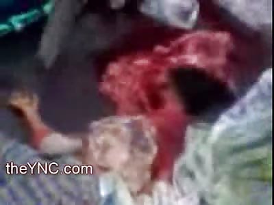 HORROR: Young Girl has Entire Brain Matter on the Street as she is lifted into Coffin and the Brains Picked off the Road