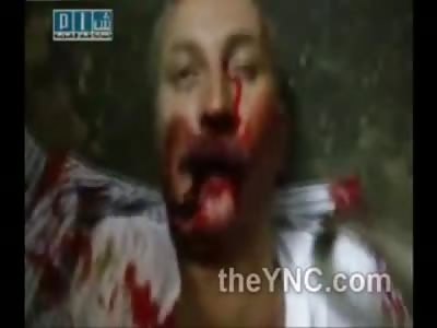 Eye Popping Gun Shot to Mans Head During Chaos in the Streets