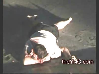 Russian Tourist who Fell from his Condo now Looks like a Chipmunk