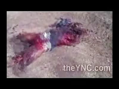 Blown To Bits..... What a Bomb Does to a Body is Pretty Damn Gruesome 