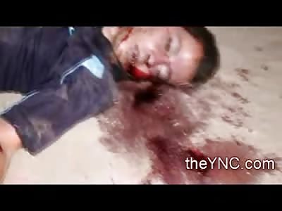 Face to Face with an Early Grave : Boy shot in the Head High Quality Footage of his Death Face