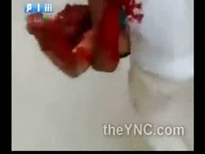 Man Carries his Family Members Bloody Body Through the Streets With his Hand Ripped off and Face Nearly Gone