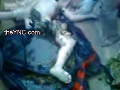 Junior High Girl Eaten by Crocodile is looked after by the Natives 